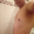 Erick Amoroso